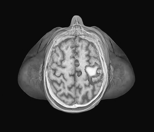 ͼƬԴZephyr/Science Photo Library